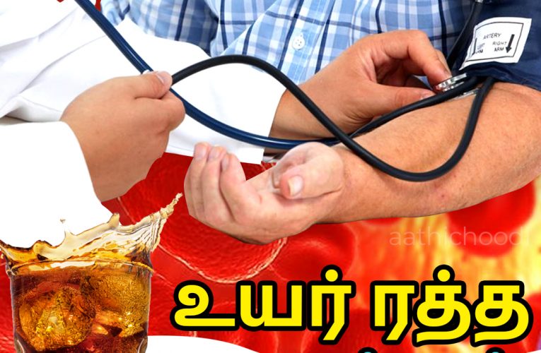 உயர் ரத்தஅழுத்தம் | High blood pressure – Hypertension | Aathichoodi