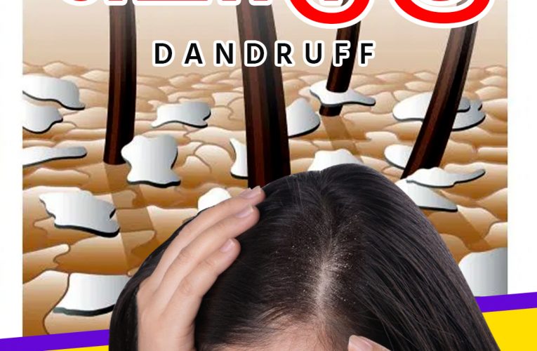 பொடுகு | Dandruff | Dr Marutharaj | Aathichoodi