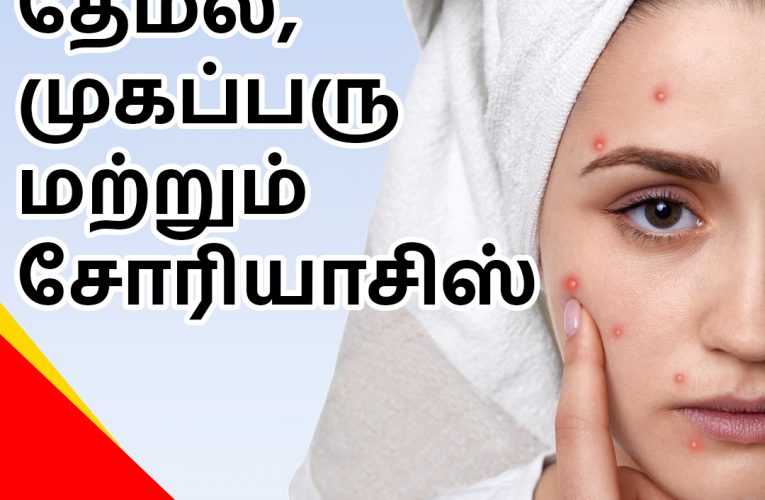 தோல் பராமரிப்பு | Skin care | Aathichoodi