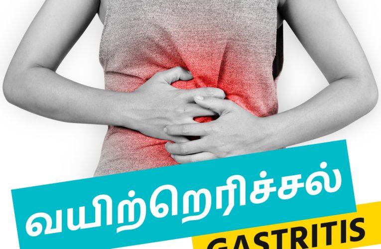 வயிற்றெரிச்சல் | Gastritis | Natural remedy for Gastritis | Aathichoodi