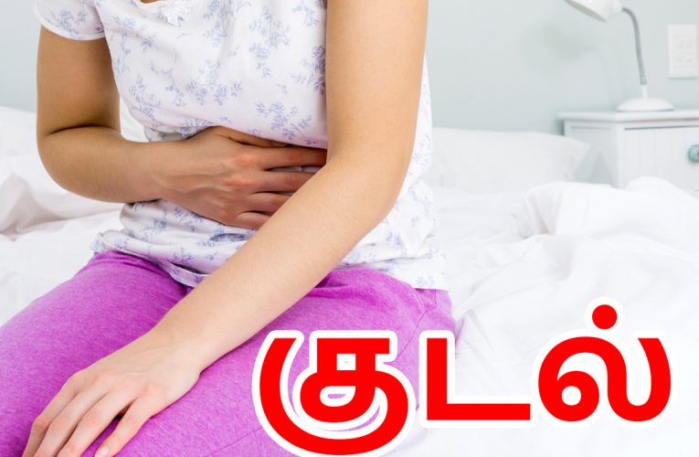 குடல் அயர்ச்சி நோய் | Irritable bowel syndrome | IBS | Aathichoodi