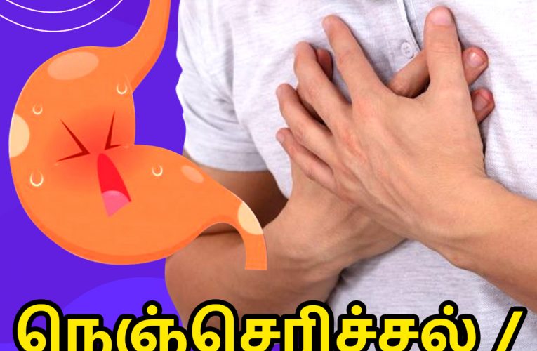 நெஞ்செரிச்சல் / புளியேப்பம் | Gastroesophageal Reflux | Aathichoodi