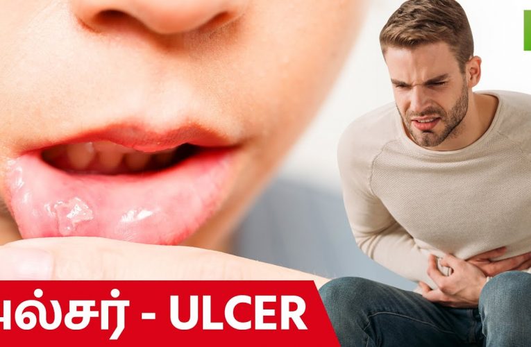 அல்சர் | Ulcers | Dr Vidhya | Aathichoodi